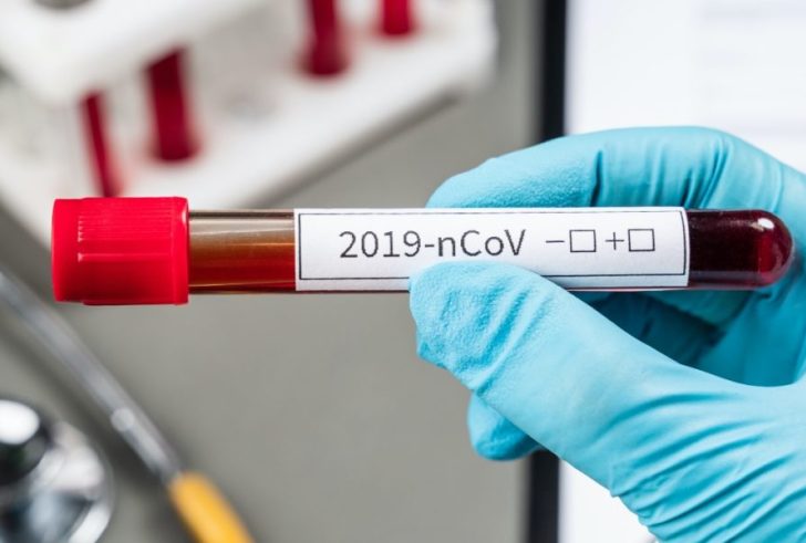 Στους 119 οι νεκροί -Πέθανε 35χρονος χωρίς υποκείμενο νόσημα στη Θεσσαλονίκη